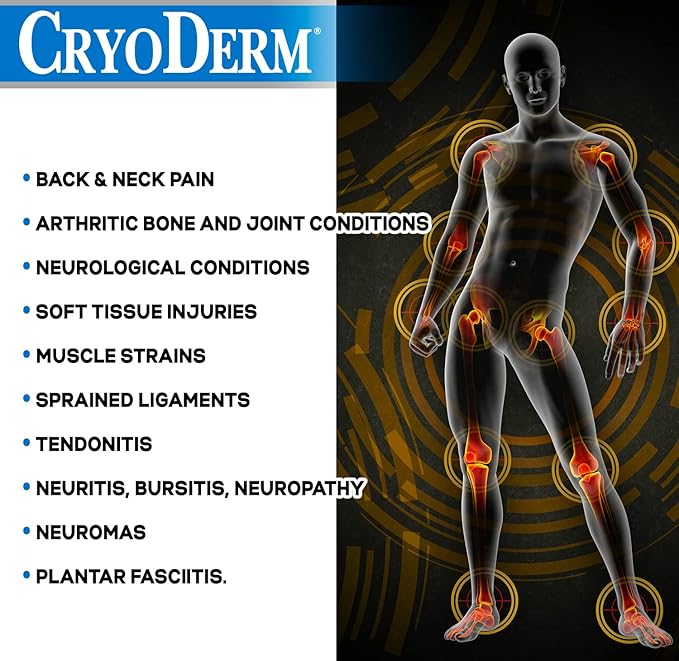 (B00GYRC4U2) - CryoDerm Cold Therapy 3 oz Roll On